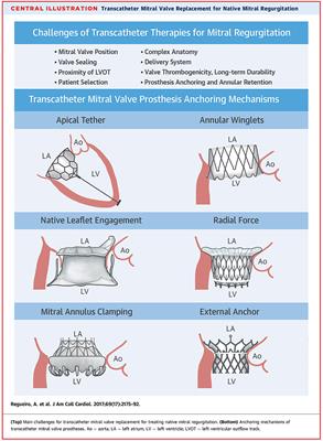 Current Devices in TMVI and Their Limitations: Focus on Tendyne